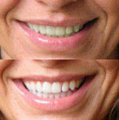 Dentway White Strips